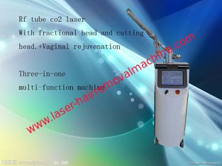 Warts Removal Fractional Co2 Laser Equipment Gray + White Color For Skin Tightening